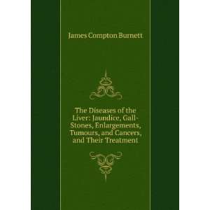   , and Cancers, and Their Treatment: James Compton Burnett: Books