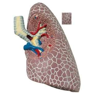 Diseased Lung Model  Industrial & Scientific