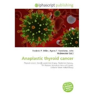  Anaplastic thyroid cancer (9786132711236) Books