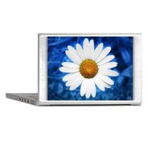  Laptop Notebook 15 Skin Cover Daisy Energy Blue 