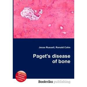  Pagets disease of bone Ronald Cohn Jesse Russell Books